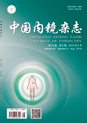 中国内镜